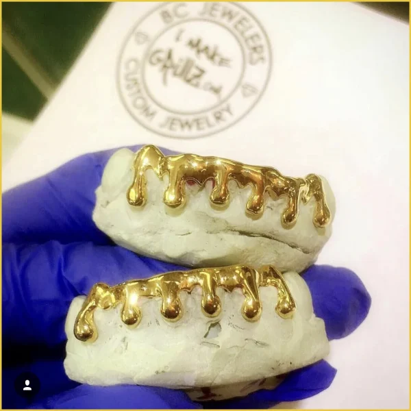Solid Gold Drip Grillz - Image 2
