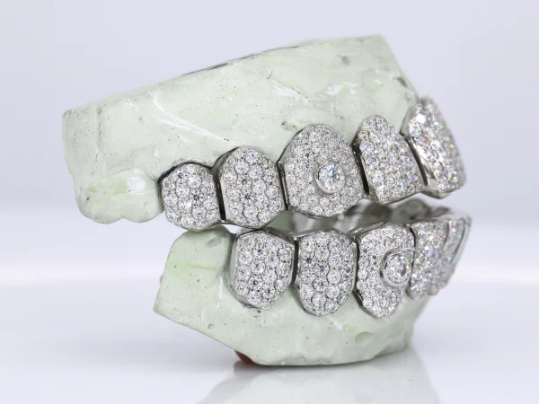 Iced VVS Moissanite Grillz with Large Center Stone - Image 2