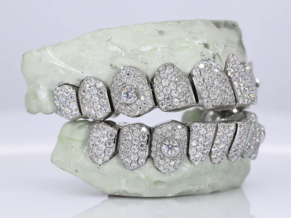 Iced VVS Moissanite with Lozenge Cut Center Stone Grillz - Image 3
