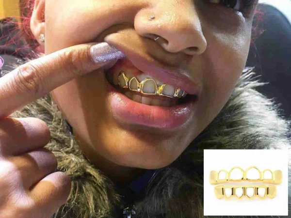 Solid Gold Open Face Grillz - Image 5