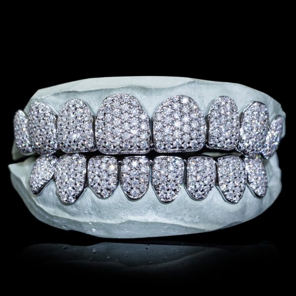 Iced VVS Moissanite Grillz (Zig Zag Setting)
