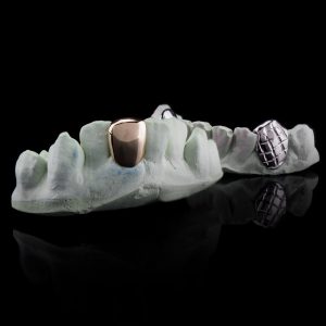 Solid Gold Single Tooth Grillz
